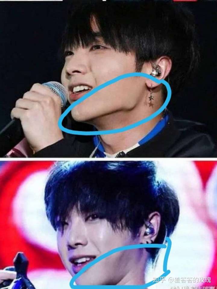 华晨宇有没有整容?