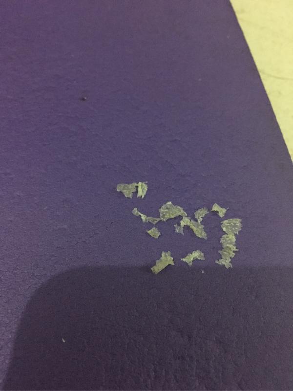 头皮屑很大块怎么办?