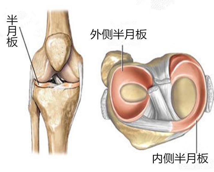 半月板损伤 半月板可以说是膝盖疼痛患者最头疼的问题之一.