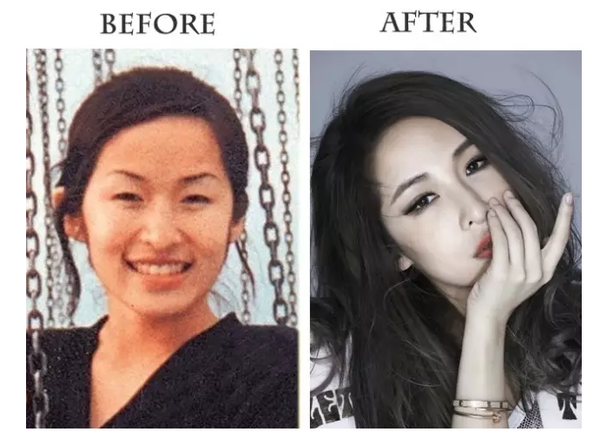 萧亚轩的割双眼皮之前的样子乃们可能都认不出来,山根也很低,眼窝也