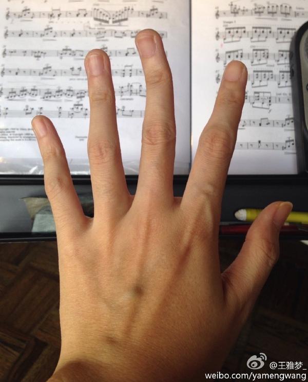 学吉他伤左手手指吗?