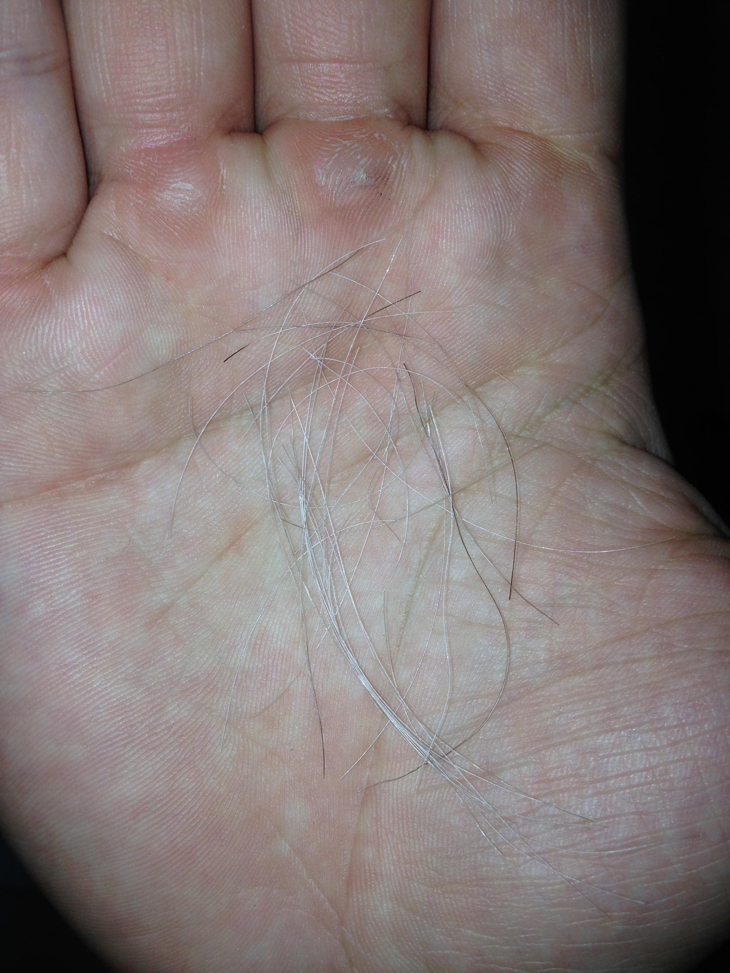 <em>头发又黑又多</em>的人是不是白头发也会很多? - 知