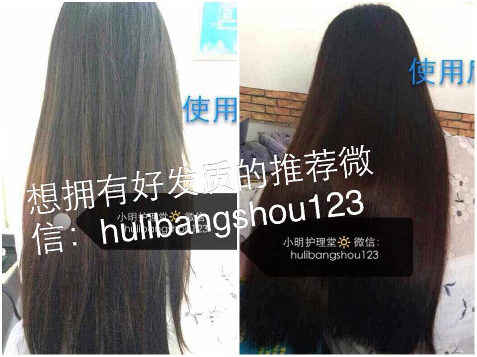 头皮出油,发质受损怎么<em>护理</em>才好啊? - <em>头发</em> - <em>知乎</em>