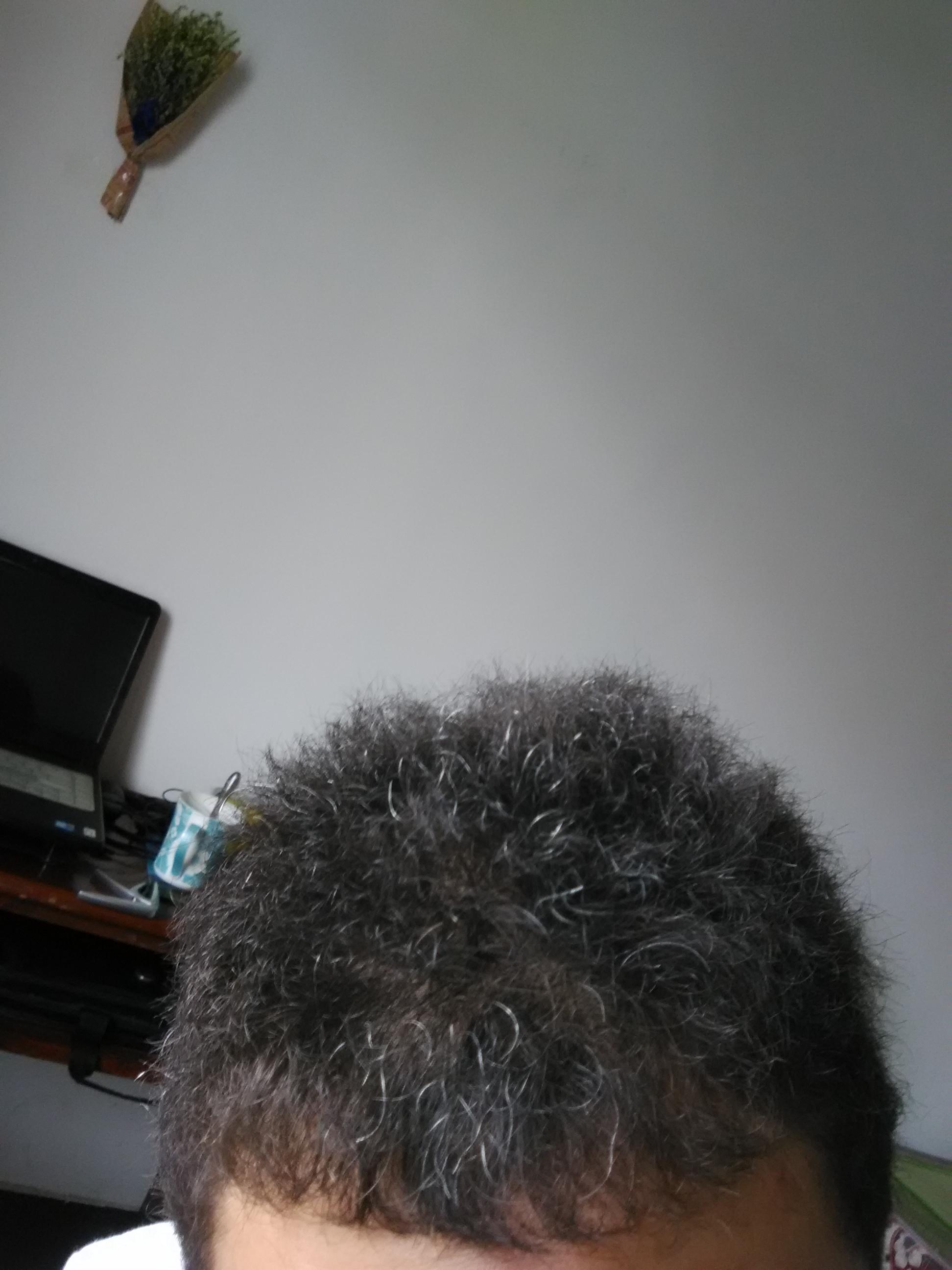 <em>男生头发</em>自然<em>卷</em>超卷,量少还软,求大神出现解救