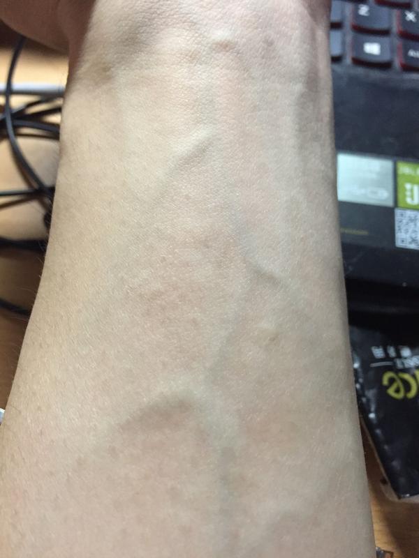不过,时至今日还能看到手腕上残留的疤.