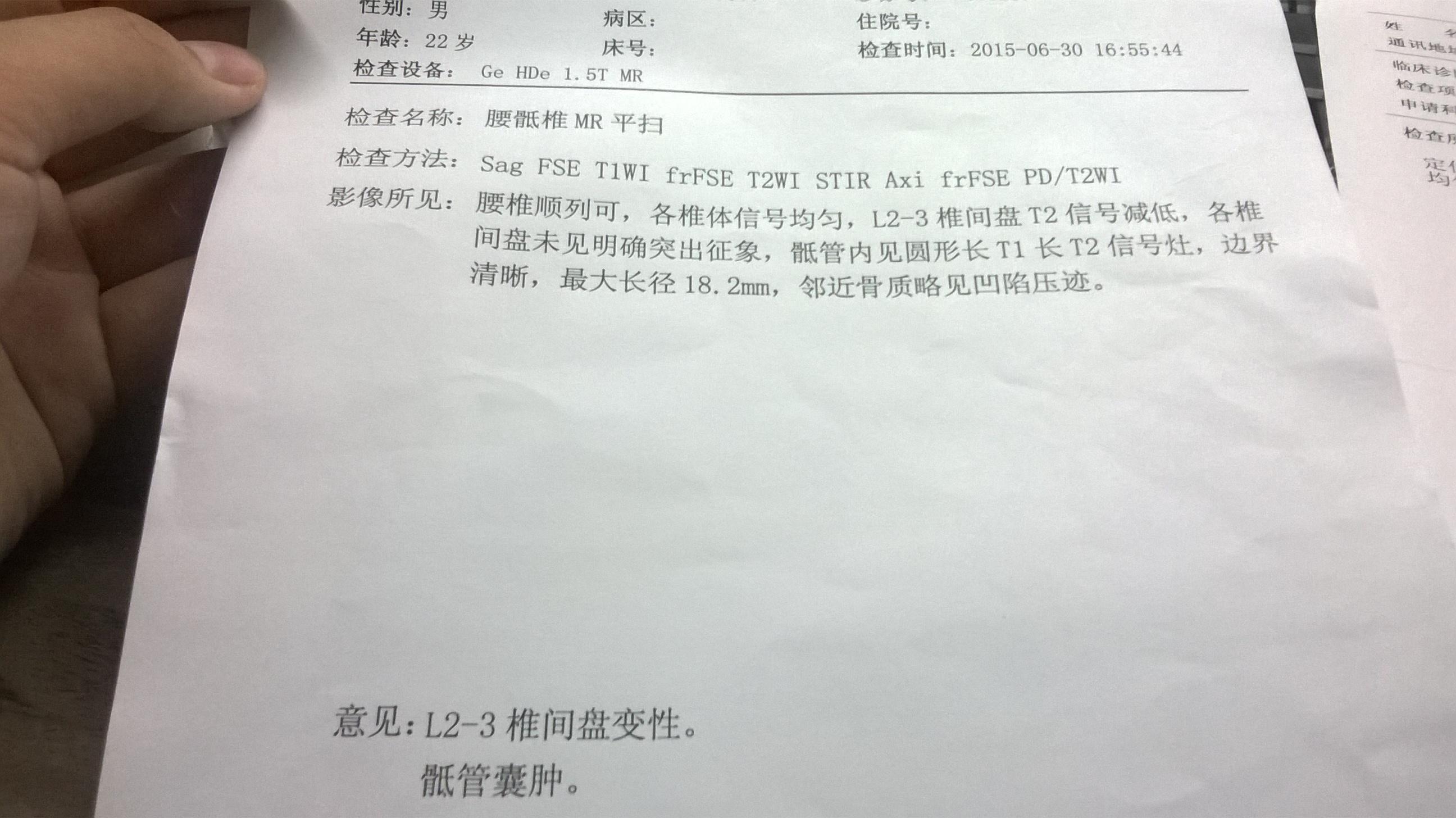 腰肌劳损需要服用非甾体抗炎吗?