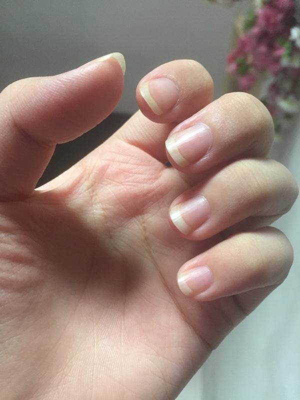然后我就想留长指甲,甲床短的人和别人比留长以后不沾肉的地方多