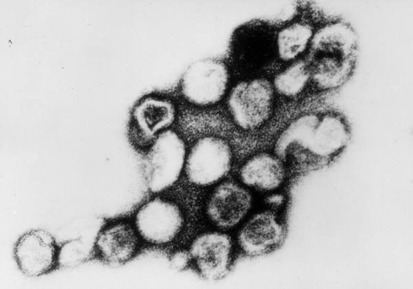 风疹病毒 rubella virus