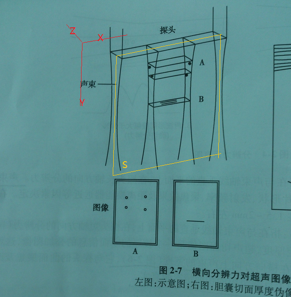 关于超声成像中的横向分辨力问题? - 黄孟钦的