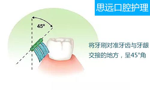 巴氏刷牙法的牙刷刷毛与牙龈成45度是什么意思?