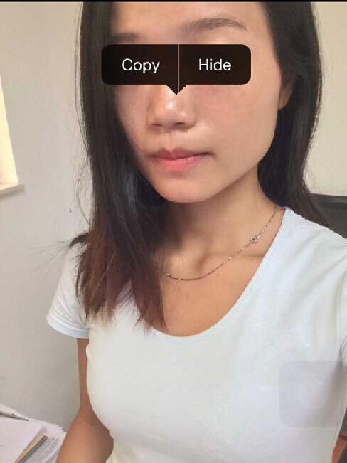 怎么跑步减肥?一般每次跑多少公里?每次跑多