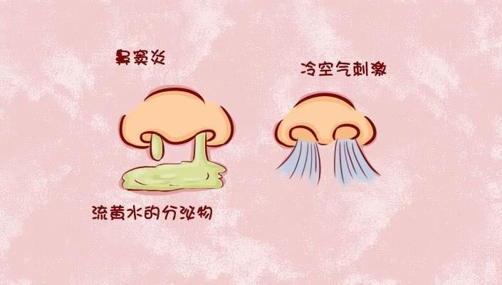 儿童鼻窦炎 一流鼻涕就是几个月 如何调理