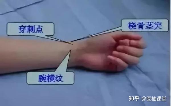 (3)操作者左手食指中指并拢沿肘横纹向内侧移动至肱动脉搏动明显处