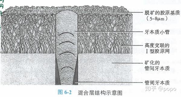 胶原纤维网,牙本质小管的位置示意图