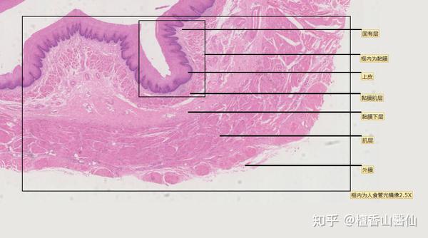 线上实验课时的切片截图及其标注: 依次为:食管,胃底,胃底腺,肠绒毛