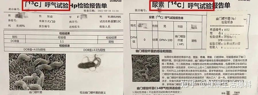 因为它检测的是hp抗体,阳性仅能代表曾经感染过,不能确定现在还是否