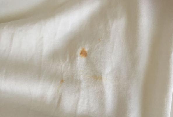 衣服有油渍怎么办我有小妙招