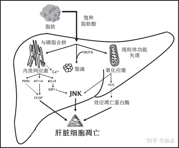 饱和脂肪酸诱导肝脏细胞功能障碍致使非酒精性脂肪肝(nafld)和肝脏脂