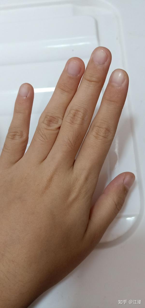 指甲很短而且很丑怎么办?