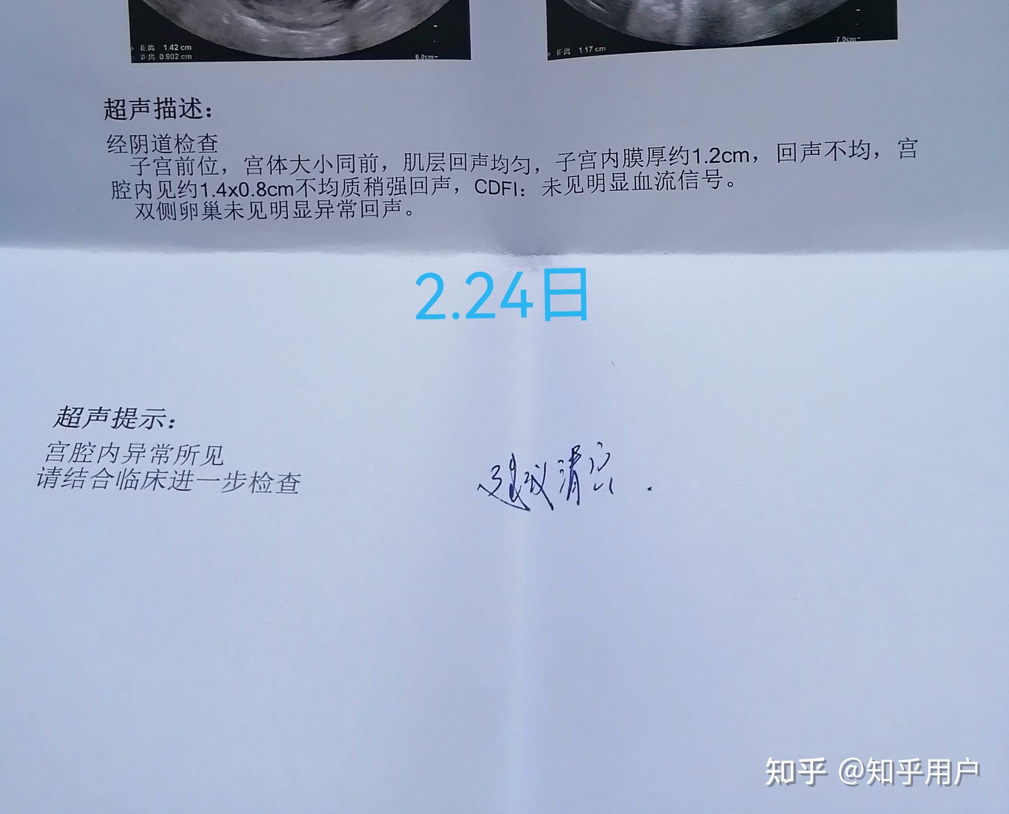 21 条评论默认时间代表月亮消灭你16天复查,4厘米残留,hcg273,医生让