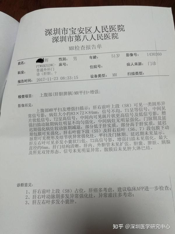 恶性晚期肝癌,34年慢性乙肝肝炎病史,10年肝硬化病史痊愈.