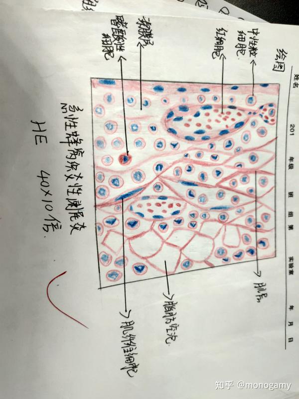 病理学红蓝铅笔绘图