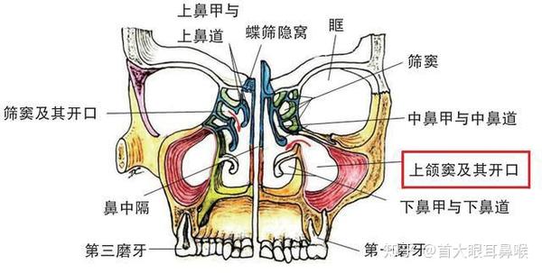 首大刘玉梅鼻窦炎必须穿刺治疗吗