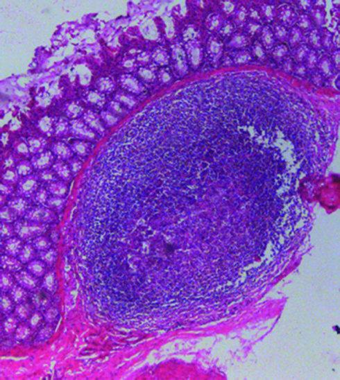 腹膜炎的猫,肠道肉芽肿性病变,组织病理学切片,见到大量炎性细胞侵润
