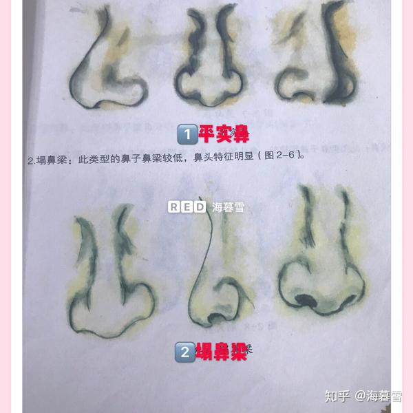 鼻头扬起,在儿童期则晓得圆巧逗人 5翘头鼻鼻梁挺直,鼻头明显上翘