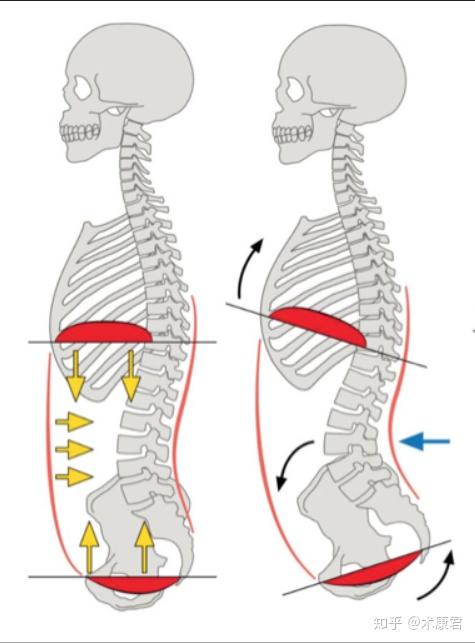 常发生的动作模式,请大家注意图中的腰椎变化(即:小燕飞加剧腰椎前凸