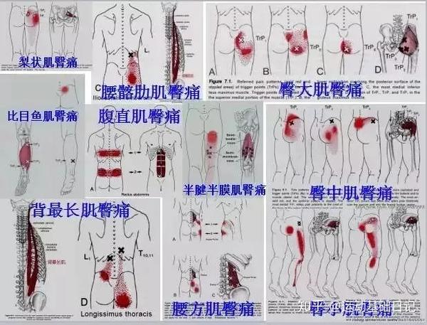 人体肌肉的疼痛扳机点全身肌肉放松按压流程图