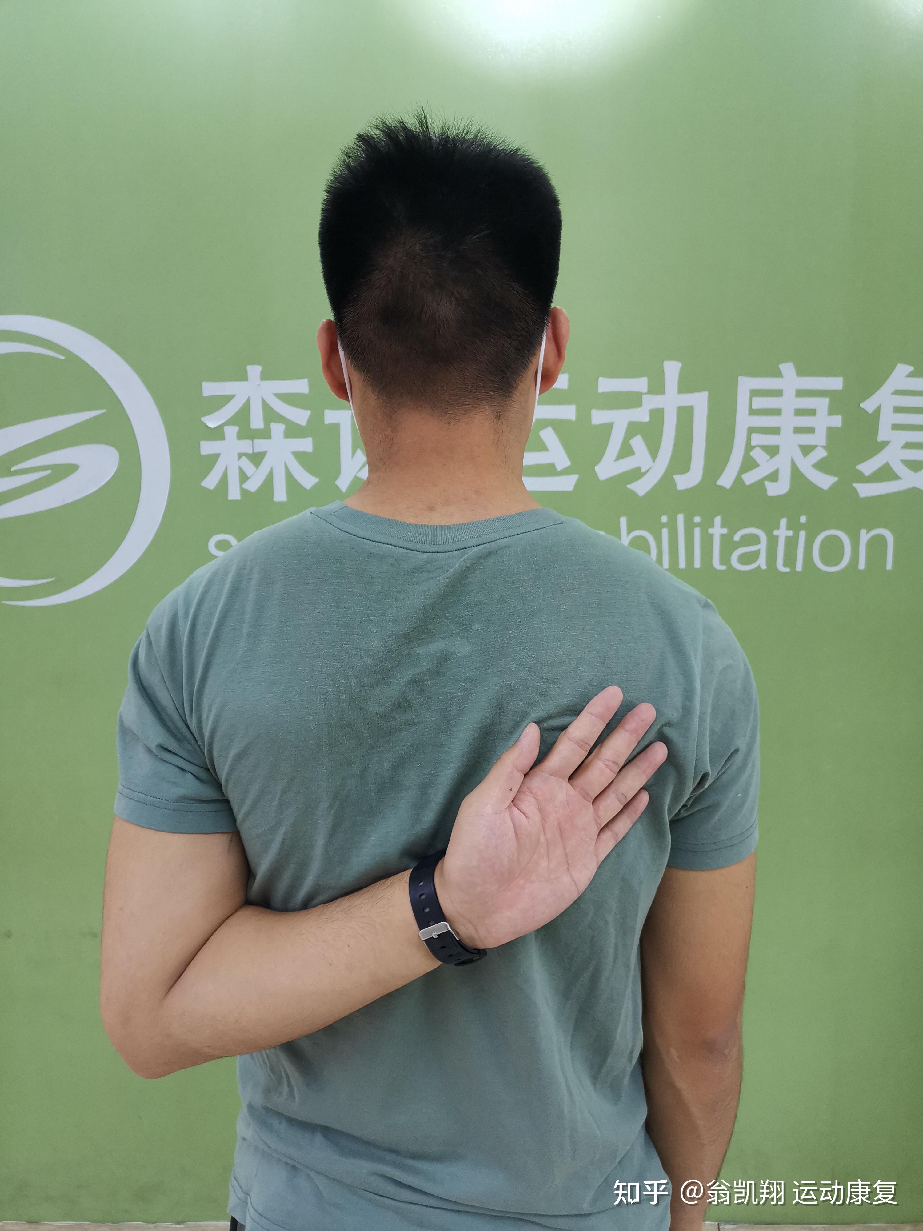 怎么改善翼状肩胛,拥有正常好看的背呢?1.日常姿势的调整2.