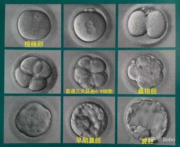 试管婴儿你是否需要养囊囊胚移植的相关问题