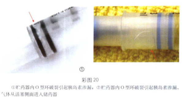 胰岛素泵输注导管针头埋置部位