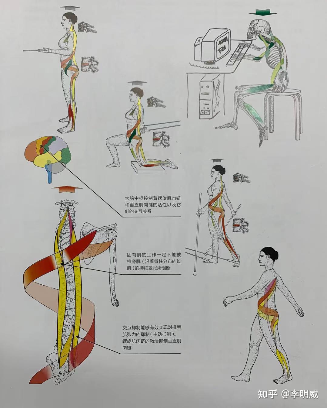 为什么sps螺旋链技术可以促进椎间盘突出更好地康复