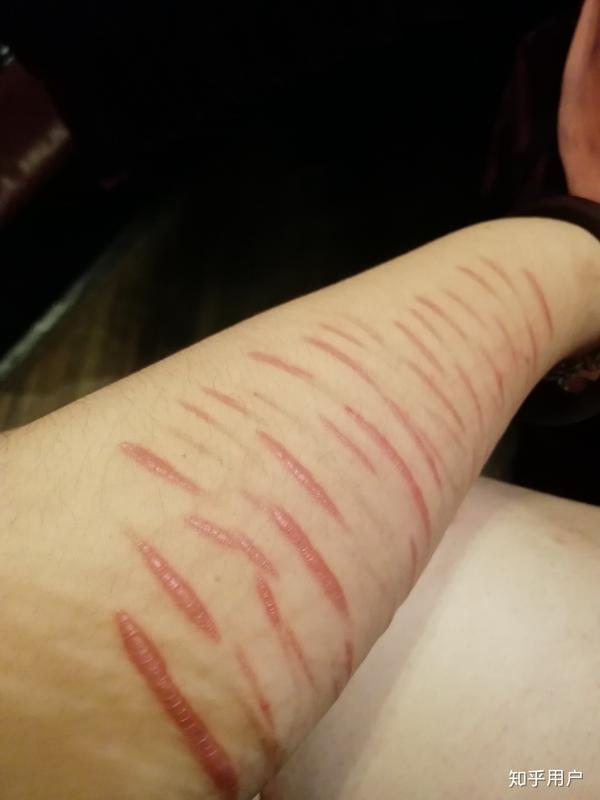 自残,双相情感障碍,想自杀,莫名拒绝所有人的好,包括男朋友的,一切的