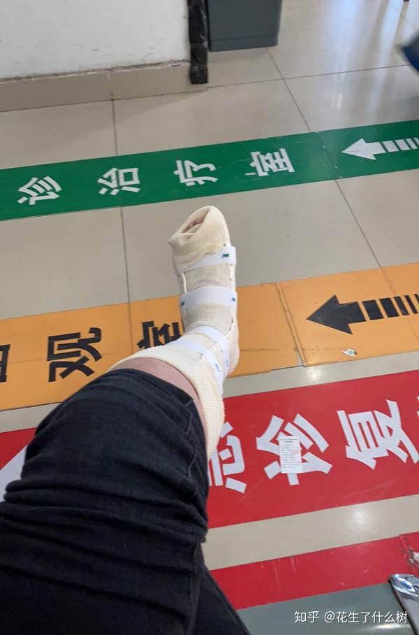 第五跖骨基底部骨折-心酸历程