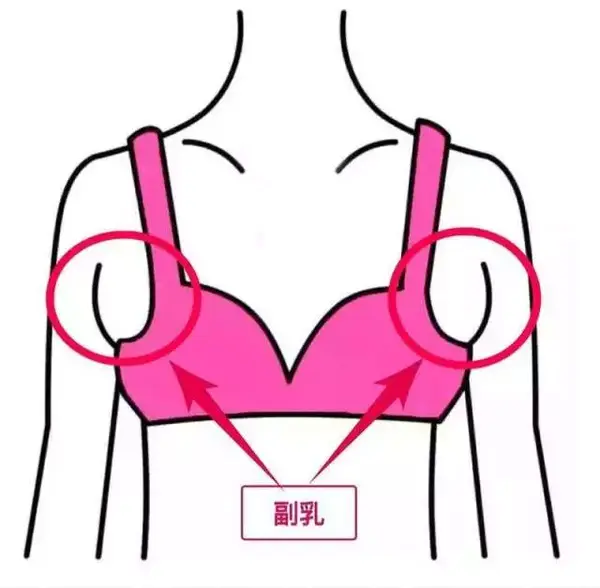 你腋下的是副乳,还是赘肉?90%的女生都可以这样消灭"假性副乳"!