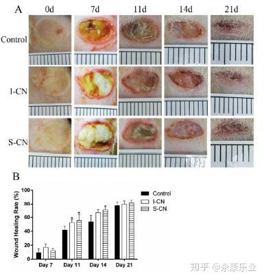 电纺胶原蛋白肽壳聚糖原位交联纳米纤维促进伤口愈合