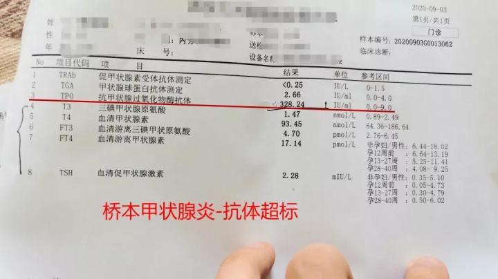 都是甲状腺炎桥本甲状腺炎和亚急性甲状腺炎的区别在哪