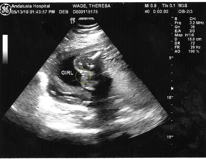 如何根据超声波报告知道胎儿的性别的?