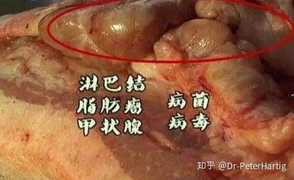 dph大家谈之色变的淋巴肉会对身体造成多大伤害