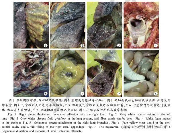 首份新冠患者遗体解剖报告:病变聚焦肺部,其他脏器损伤证据不足!