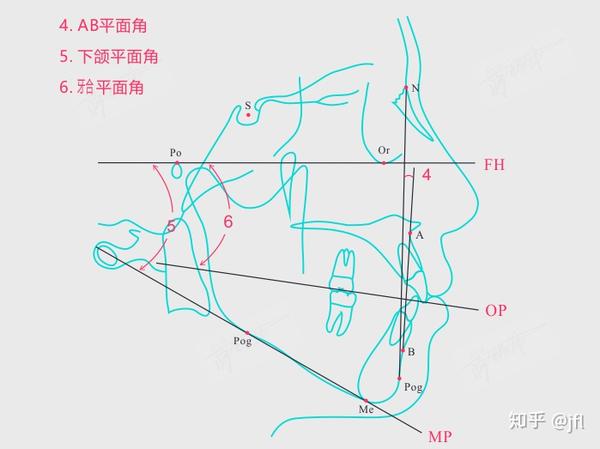 头影测量 downs分析法 ab平面角(ab-npog) 下颌平面角(fma mp-fh) 牙