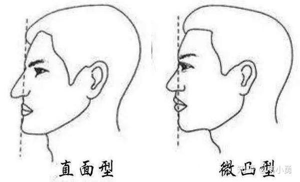 如果鼻前嵴这个点连线左边的位置,并且距离较大,那么看起来就会嘴非常