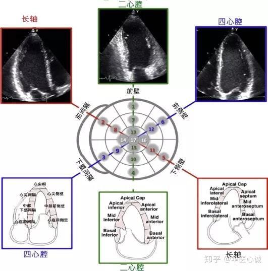 长轴切面,经过患者心脏的10点钟和4点钟的方向,即前间隔和下侧壁的