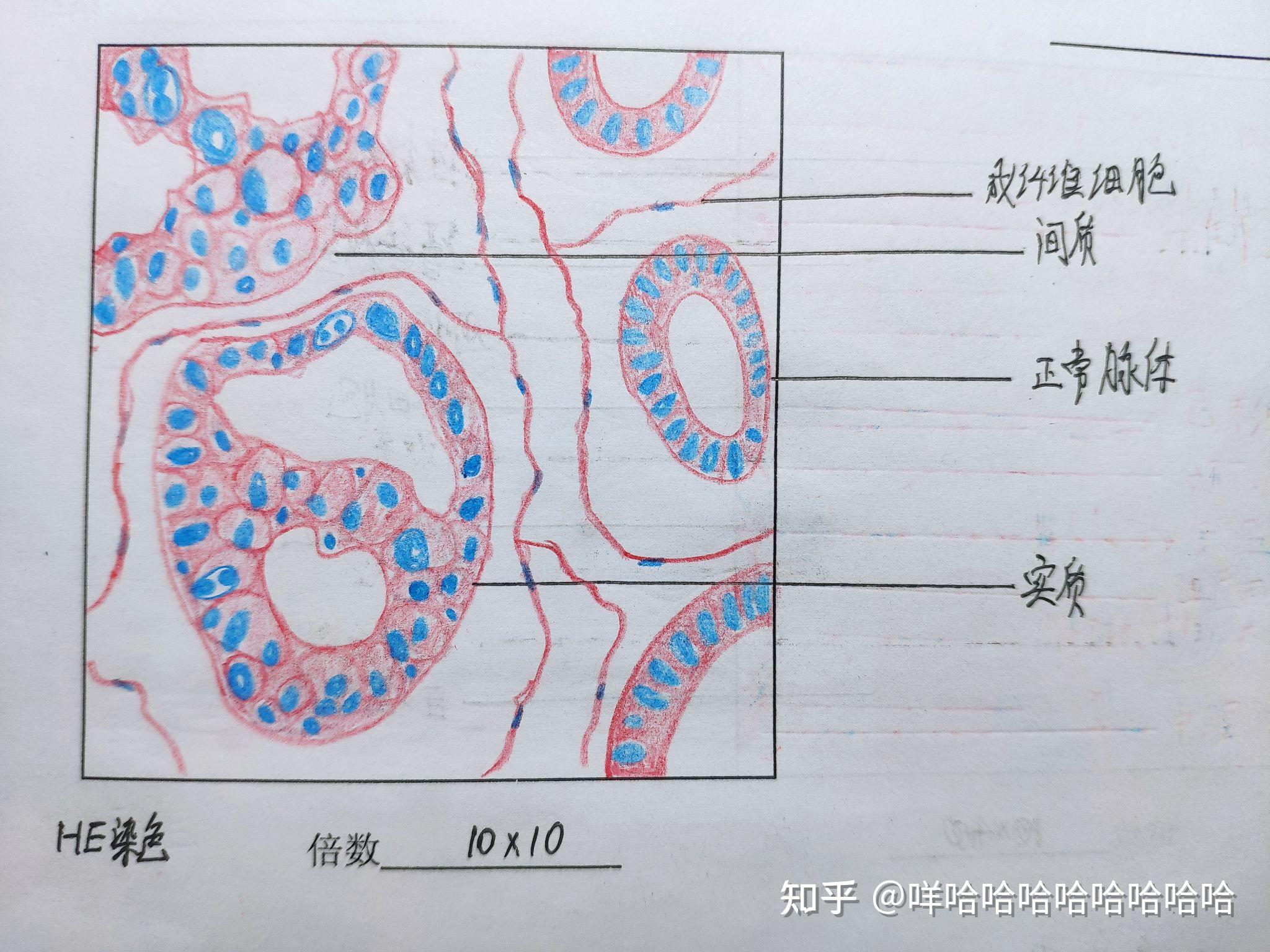 病理学红蓝铅笔图