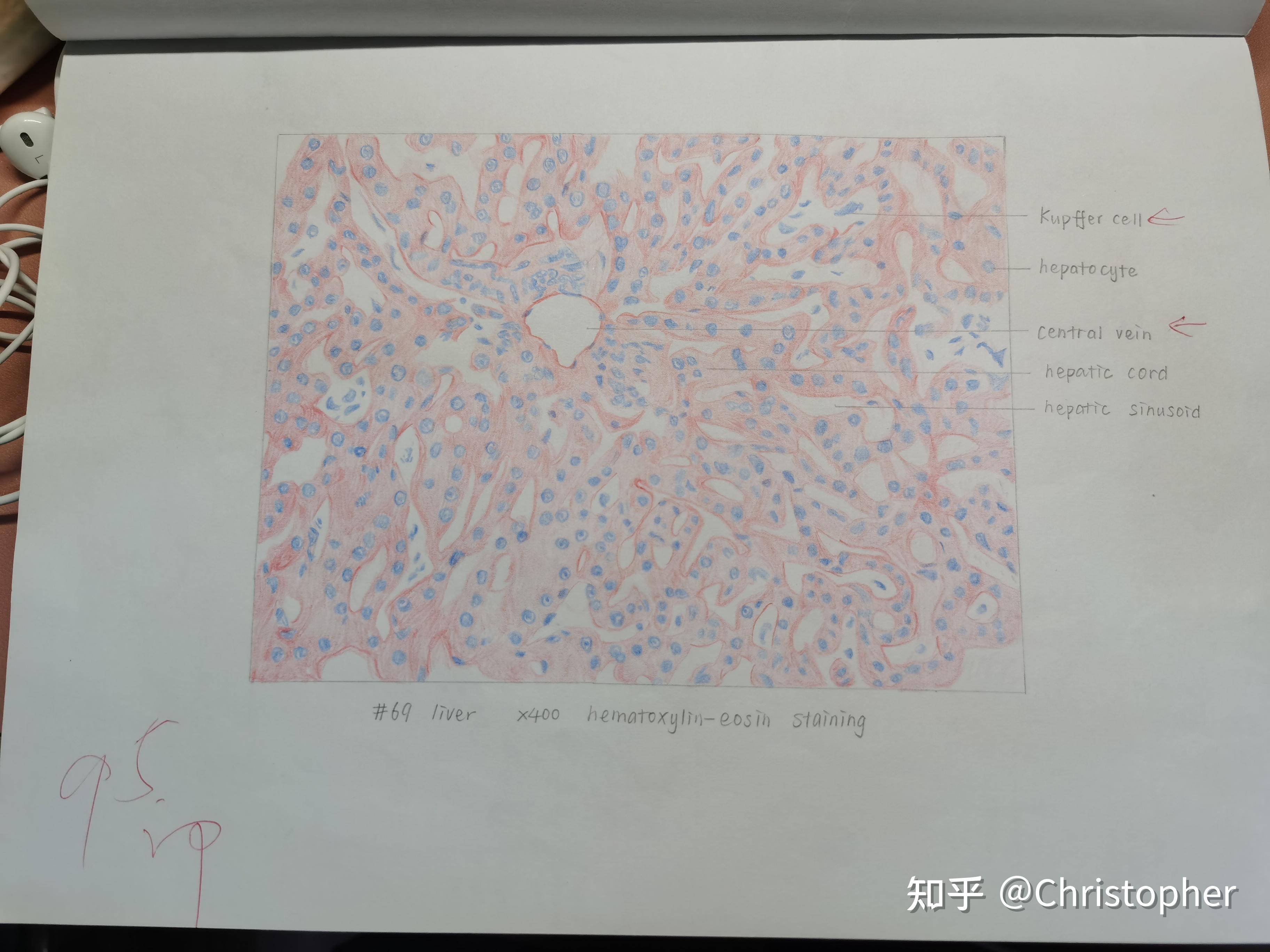 但是对于小菜鸡本鸡来说可能还是有些错误啥的(>﹏>) 肝小叶肺(终末支