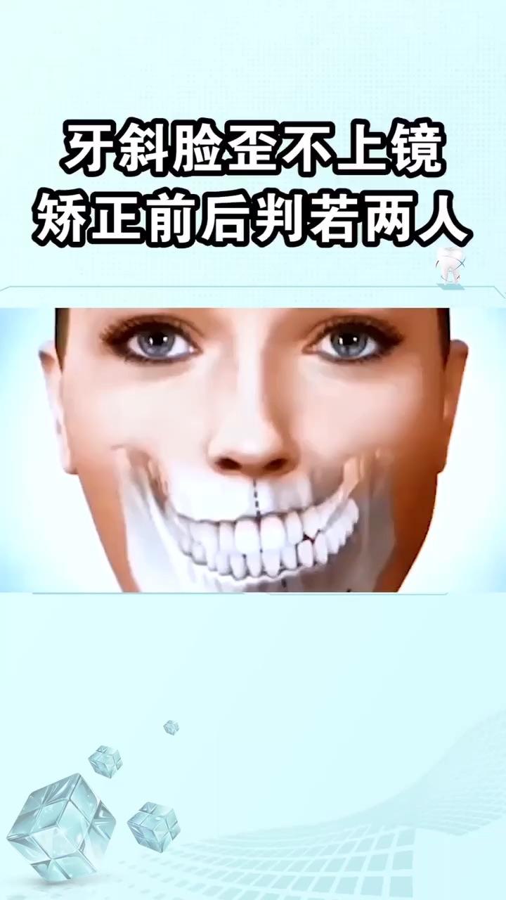 牙齿外凸像兔牙怎么矫正
