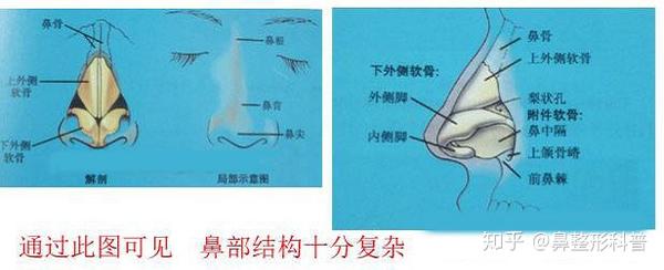 在中,上鼻道和蝶筛隐窝有鼻旁窦开口,下鼻道有鼻泪管开口.